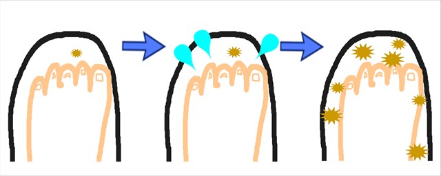 ミョウバン対策